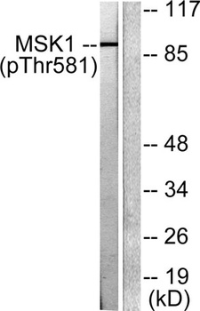 MSK1 (phospho Thr581) rabbit pAb Antibody