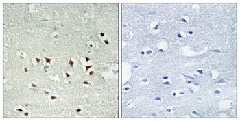 MAPKAPK-2 (phospho Thr334) rabbit pAb Antibody
