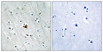 MAPKAPK-2 (phospho Ser272) rabbit pAb Antibody