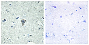 GPR37L1 rabbit pAb Antibody