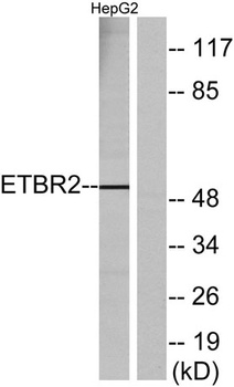 GPR37L1 rabbit pAb Antibody