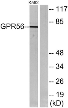 GPR56 rabbit pAb Antibody
