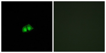 TRIP15 rabbit pAb Antibody