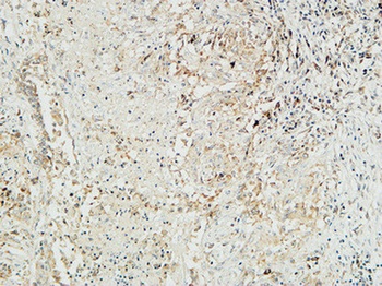 Mucin 16 rabbit pAb Antibody
