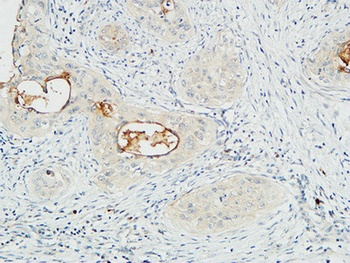 Mucin 16 rabbit pAb Antibody