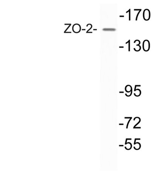 ZO-2 rabbit pAb Antibody