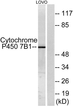 CYP7B1 rabbit pAb Antibody