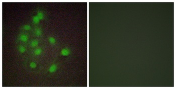 HAND1 rabbit pAb Antibody