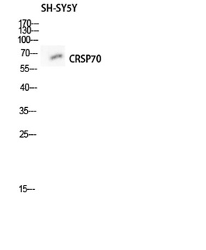 CRSP70 rabbit pAb Antibody