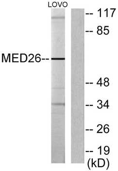 CRSP70 rabbit pAb Antibody