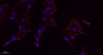 PERK rabbit pAb Antibody