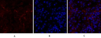 PERK rabbit pAb Antibody