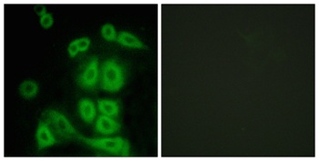 FXR2 rabbit pAb Antibody
