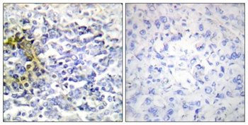 FXR2 rabbit pAb Antibody