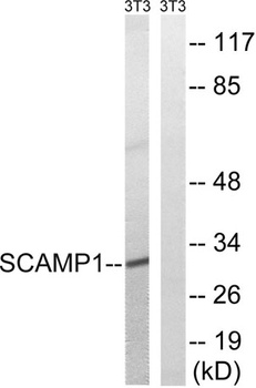 SCAMP1 rabbit pAb Antibody