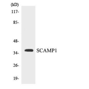 SCAMP1 rabbit pAb Antibody