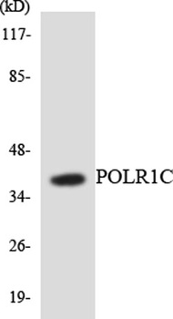 RPA40 rabbit pAb Antibody
