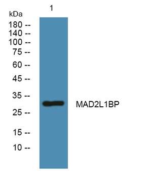 MAD2L1BP rabbit pAb Antibody