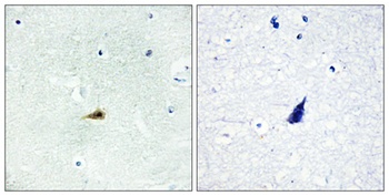 SMRTe rabbit pAb Antibody
