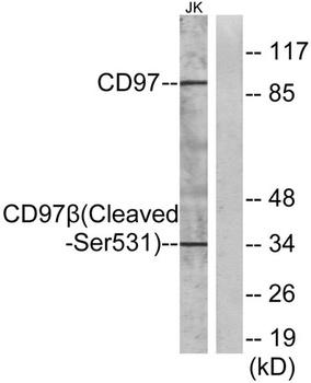 Cleaved-CD97β (S531) rabbit pAb Antibody