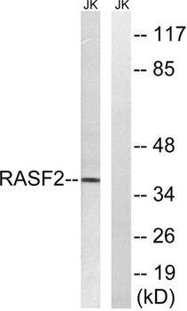 RASSF2 rabbit pAb Antibody