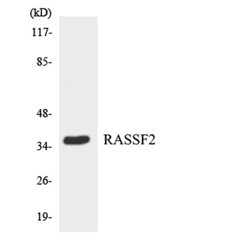 RASSF2 rabbit pAb Antibody