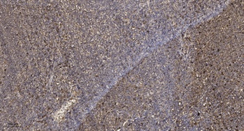 RASSF2 rabbit pAb Antibody