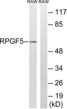 Repac rabbit pAb Antibody
