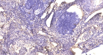 Repac rabbit pAb Antibody