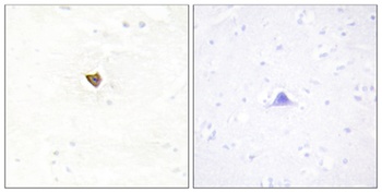 Jamip2 rabbit pAb Antibody