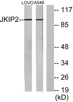 Jamip2 rabbit pAb Antibody