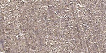 Gab 2 rabbit pAb Antibody