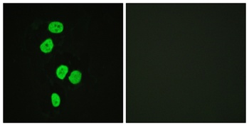 TBC1D4 rabbit pAb Antibody