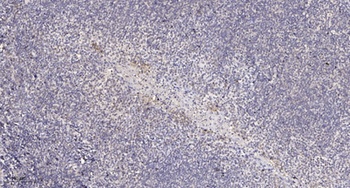 TBC1D4 rabbit pAb Antibody
