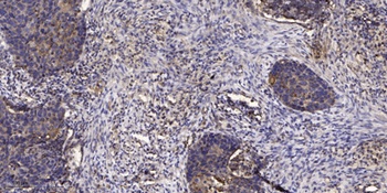 IP3R-I rabbit pAb Antibody