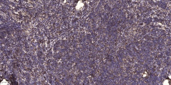LAT rabbit pAb Antibody