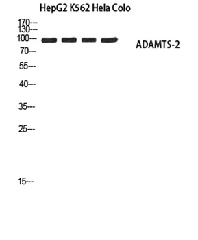 ADAMTS-2 rabbit pAb Antibody