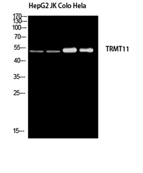 TRMT11 rabbit pAb Antibody