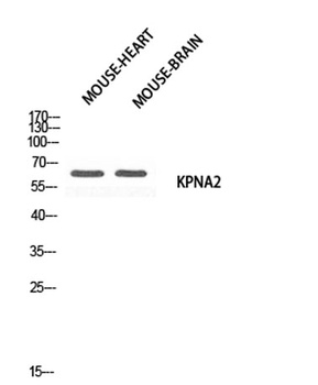 Karyopherin α2 rabbit pAb Antibody