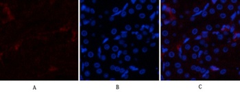 p300 rabbit pAb Antibody