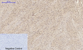 p300 rabbit pAb Antibody
