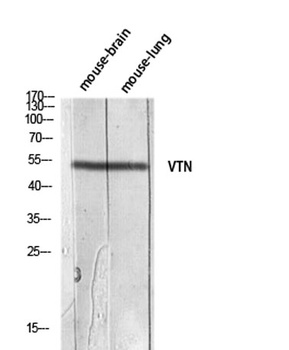 Vitronectin rabbit pAb Antibody
