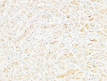 CD26 rabbit pAb Antibody