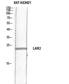 CD306 rabbit pAb Antibody