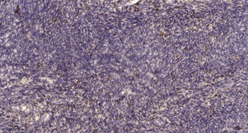 PGLYRP1 rabbit pAb Antibody