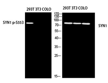 Synapsin-1 rabbit pAb Antibody