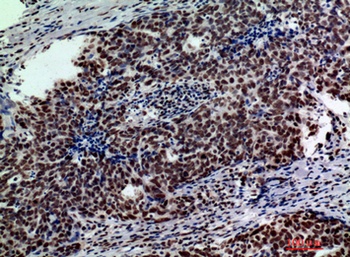 Galactosidase β rabbit pAb