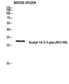 14-3-3-pan (Acetyl Lys51/49) rabbit pAb Antibody