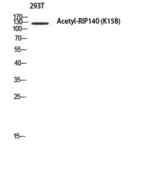 RIP140 (Acetyl Lys158) rabbit pAb Antibody