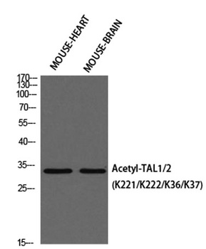 TAL1/2 (Acetyl Lys221/Acetyl Lys222/Acetyl Lys36/Acetyl Lys37) rabbit pAb Antibody